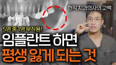 임플란트 치과 임플란트의 치명적 부작용 3가지 설명